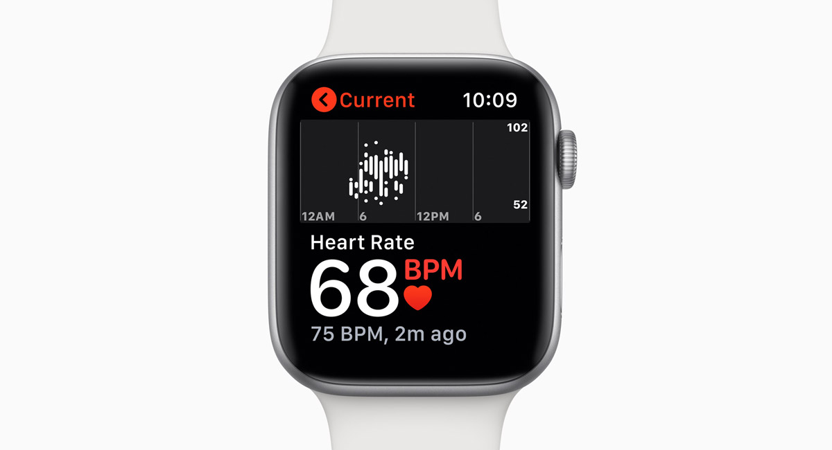 Apple Watch Detects And Identifies Another AFib Patient In Her 